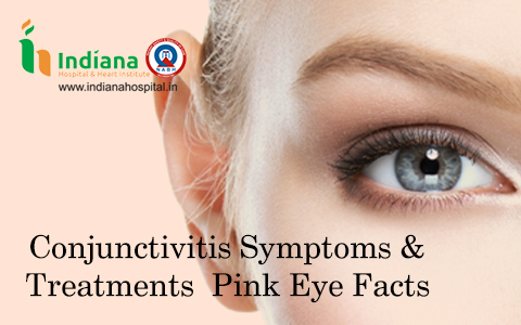 Conjunctivitis Symptoms & Treatments | Pink Eye Facts