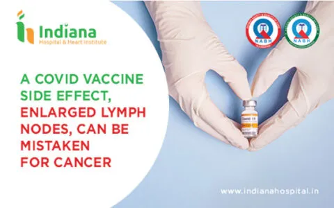 A Covid vaccine side effect, enlarged lymph nodes, can be mistaken for cancer